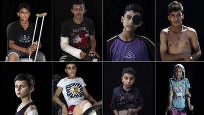 Gazze’de yürek yakan tablo: 5 binden fazla çocuk uzvunu kaybetti!