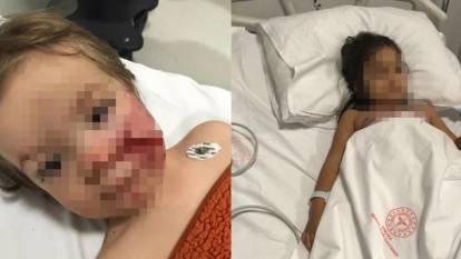 Ankara'da 2 çocuğun yaralandığı Pitbull faciasında flaş gelişme! Köpeğin sahibi tutuklandı